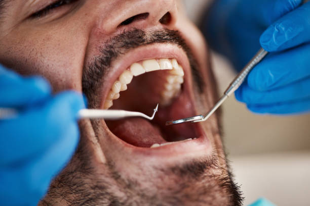Best Orthodontic Emergency Dentist in Bloomingdale, GA