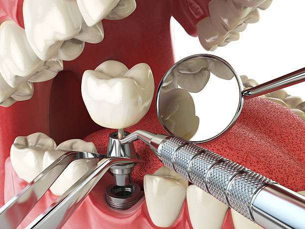 Best Urgent Dental Care for Toothache in Bloomingdale, GA