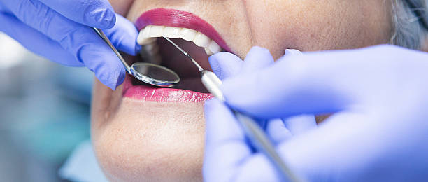 Best Broken or Cracked Tooth Emergency Dentist in Bloomingdale, GA