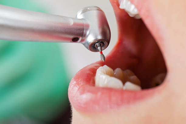Best Emergency Dentist for Special Needs Patients in Bloomingdale, GA
